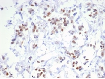 Recombinant Estrogen Receptor, alpha (Marker of Estrogen Dependence) Antibody