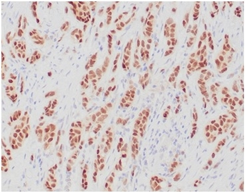 Recombinant Estrogen Receptor, alpha (Marker of Estrogen Dependence) Antibody