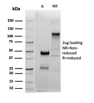 Recombinant Estrogen Receptor, alpha (Marker of Estrogen Dependence) Antibody