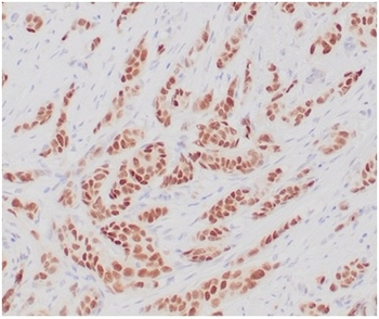 Recombinant Estrogen Receptor, alpha (Marker of Estrogen Dependence) Antibody