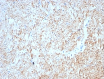 Desmin (Muscle Cell Marker) Antibody