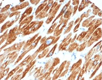 Desmin (Muscle Cell Marker) Antibody