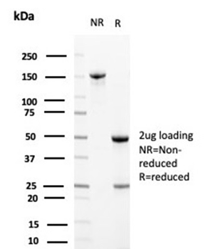 Clusterin / Apolipoprotein J (APO-J) Antibody