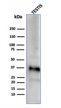 Clusterin / Apolipoprotein J (APO-J) Antibody