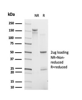 Interferon regulatory factor 9 / IRF-9 Antibody