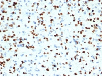 Recombinant OLIG2 (Marker of Glial Brain Tumors) Antibody