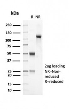 Recombinant OLIG2 (Marker of Glial Brain Tumors) Antibody