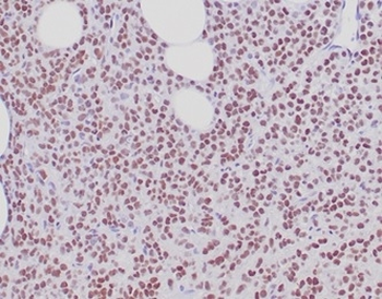 Recombinant Estrogen Receptor, alpha (Marker of Estrogen Dependence) Antibody