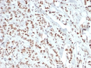 Recombinant Estrogen Receptor, alpha (Marker of Estrogen Dependence) Antibody
