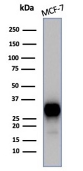 Recombinant Estrogen Receptor, alpha (Marker of Estrogen Dependence) Antibody