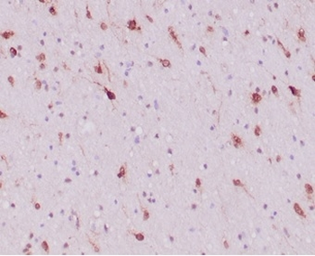 IDH1 Antibody
