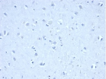 Recombinant IDH1-R132H (Isocitrate Dehydrogenase) Antibody