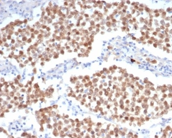 Recombinant OCT-4 (POU5F1) (Germ Cell Tumor Marker) Antibody
