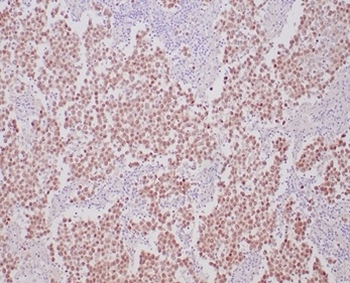 Recombinant OCT-4 (POU5F1) (Germ Cell Tumor Marker) Antibody
