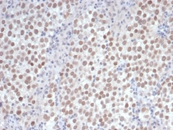 Recombinant OCT-4 (POU5F1) (Germ Cell Tumor Marker) Antibody