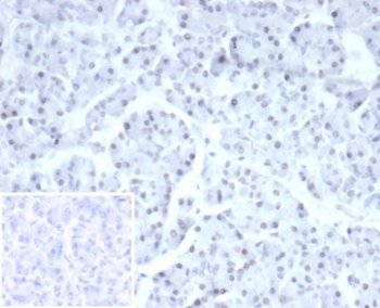 Recombinant PHOX2B Antibody