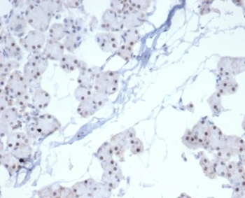 Recombinant PHOX2B Antibody