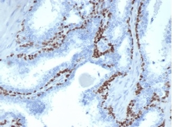 Recombinant p63 (Squamous, Basal & Myoepithelial Cell Marker) Antibody