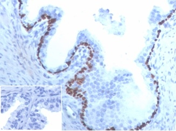 Recombinant p63 (Squamous, Basal & Myoepithelial Cell Marker) Antibody