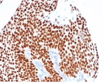 GATA3 Antibody