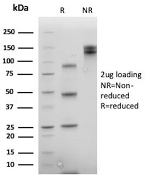 Recombinant CDX2 / Caudal Type Homeobox 2 (GI Epithelial Marker) Antibody