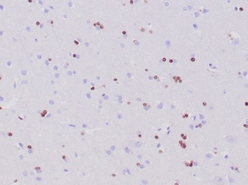 Recombinant OLIG2 (Marker of Glial Brain Tumors) Antibody