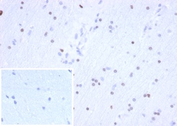 Recombinant OLIG2 (Marker of Glial Brain Tumors) Antibody