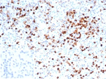 MPO Antibody