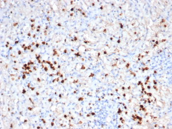 Recombinant Granzyme B (NK/T-Cell Lymphoma Marker) Antibody