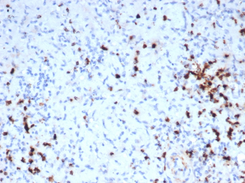 Recombinant Granzyme B (NK/T-Cell Lymphoma Marker) Antibody