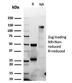 Recombinant Granzyme B (NK/T-Cell Lymphoma Marker) Antibody
