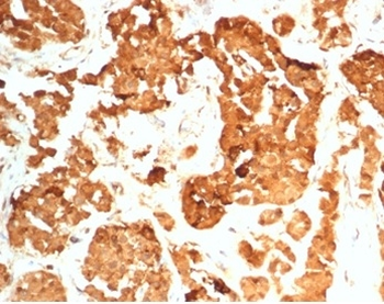 Recombinant HCG-beta (Pregnancy & Choriocarcinoma Marker) Antibody