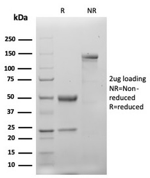 Recombinant Cytokeratin 20 (KRT20) (Colorectal Epithelial Marker) Antibody