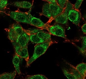 MED21 Antibody