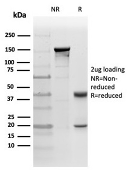 Protein Kinase C iota / lambda / PRKCI Antibody