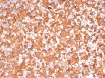 Protein Kinase C iota / lambda / PRKCI Antibody