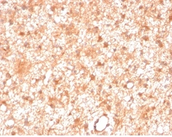 Protein Kinase C iota / lambda / PRKCI Antibody