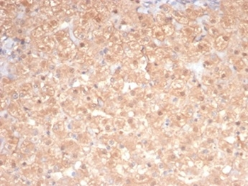 Protein Kinase C iota / lambda / PRKCI Antibody