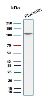 Recombinant E-Cadherin (CDH1) / CD324 (Intercellular Junction Marker) Antibody