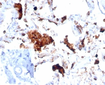 Recombinant Napsin A (Lung Adenocarcinoma Marker) Antibody
