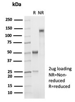 Recombinant Napsin A (Lung Adenocarcinoma Marker) Antibody