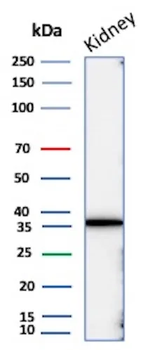 Recombinant Napsin A (Lung Adenocarcinoma Marker) Antibody