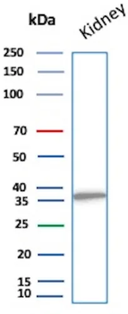 Recombinant Napsin A (Lung Adenocarcinoma Marker) Antibody