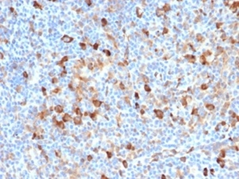 Fascin-1 (Reed-Sternberg Cell Marker) Antibody