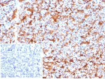 Fascin-1 (Reed-Sternberg Cell Marker) Antibody