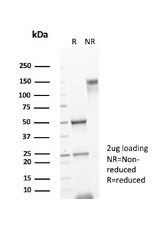 CD117 / c-Kit (Marker for Gastrointestinal Stromal Tumors) Antibody
