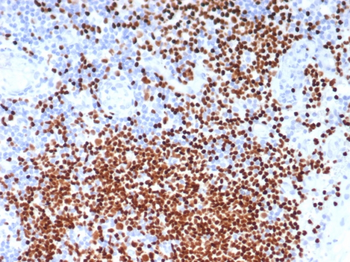 SOX11 (Mantle Cell Lymphoma Marker) Antibody