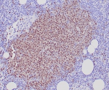 SOX11 (Mantle Cell Lymphoma Marker) Antibody