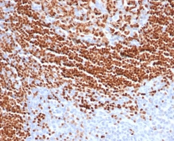 SOX11 (Mantle Cell Lymphoma Marker) Antibody