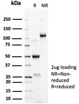 Recombinant ACE2 / Angiotensin | Converting Enzyme 2 Antibody